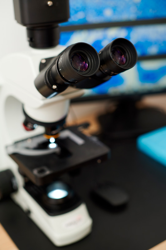 años 60 inspiracion editorial Twiggy